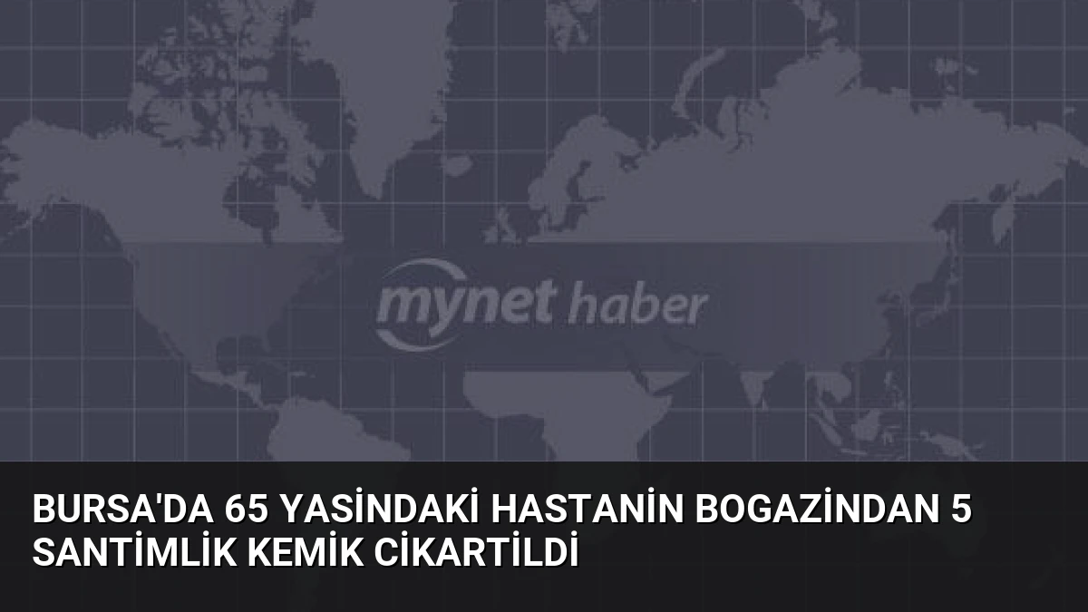 Bursa’da 65 Yasindaki Hastanin Bogazindan 5 Santimlik Kemik Cikartildi